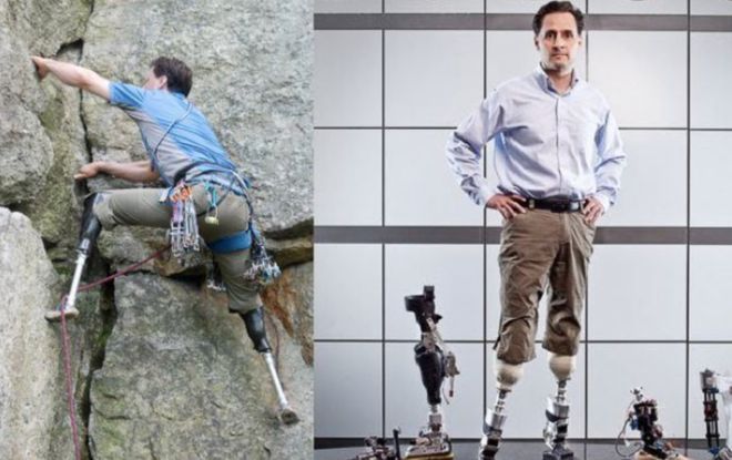 曾因攀岩事故双腿截肢MIT教授开发连接大脑神经的仿生腿帮助截肢者恢复正常行走(图2)