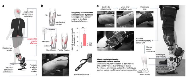 曾因攀岩事故双腿截肢MIT教授开发连接大脑神经的仿生腿帮助截肢者恢复正常行走(图3)